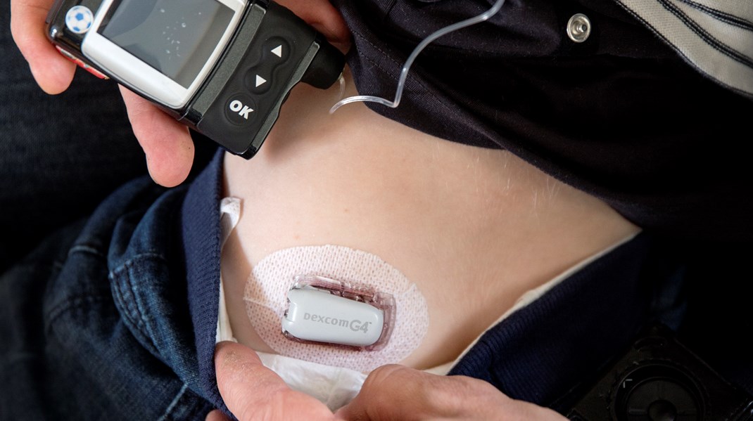 Många diabetiker får en insulinpump som fästs på kroppen, och som mäter och matar insulin till kroppen.